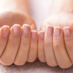 Продольные трещины на ногтях рук: причины и лечение