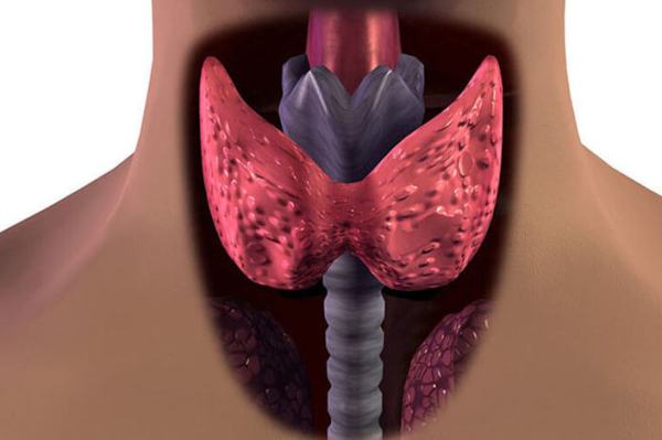 причиной витилиго могут быть болезни щитовидной железы