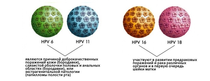 Анальные кондиломы папилломы, остроконечные кондиломы
