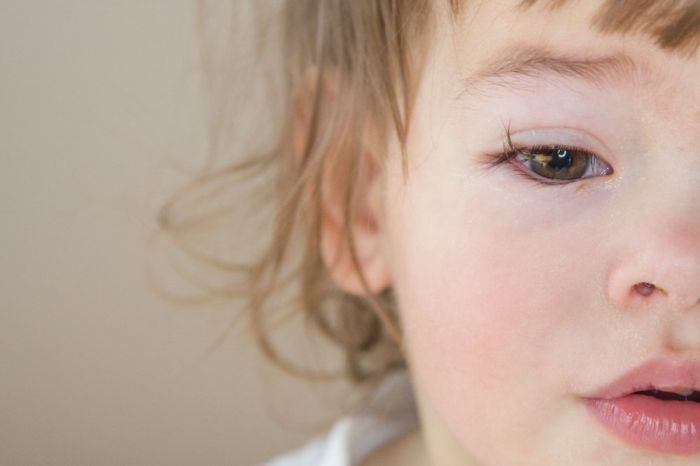 Заболевание глаз у ребенка