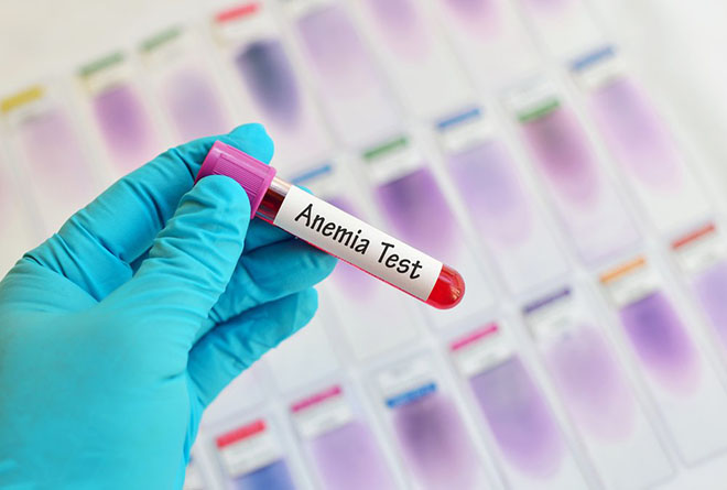 Анемия - причины и лечение