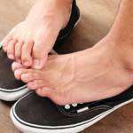 Что делать если потеют ноги: причины и лечение гипергидроза