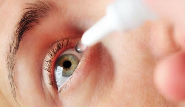 Лечение коньюктивита глазными каплями
