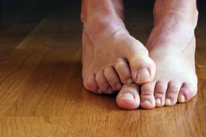 Совет 1 Грибок стопы, как им можно заразиться и как лечитьСовет 2 Как передается грибок ног