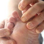 Лечение грибка ногтей у детей: медикаменты и народные средства