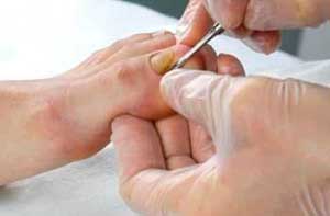 Как стирать носки при грибке ногтей способы обработки и дезинфекции