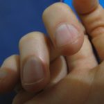 Почему ломаются ногти на руках у женщин и мужчин?