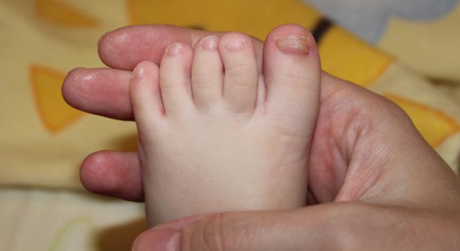 Как лечить грибок на ногах у ребенка