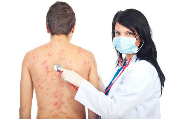 Аллергический псориаз особый тип мультифакторного заболевания
