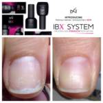 Лечение ногтей IBX System: цена, отзывы о процедуре