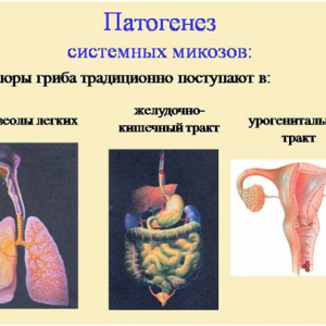 Виды лечения грибка в организме человека