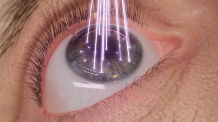 Воздействие лазера на глаза