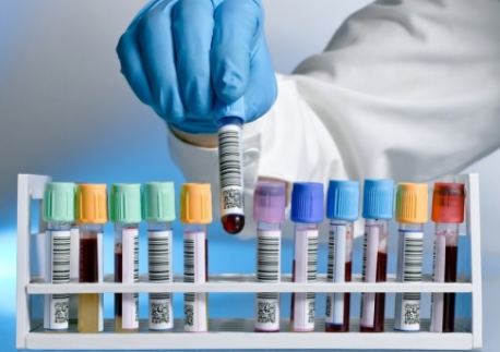 Анализ крови на иммуноглобулин: стоимость и важность